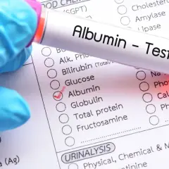 Rękawiczka w niebieskiej rękawiczce trzyma probówkę z napisem "Albumin - Test". Obok zaznaczono "Albumin" na formularzu badań, co sugeruje analizę albuminy w moczu i jej normy.