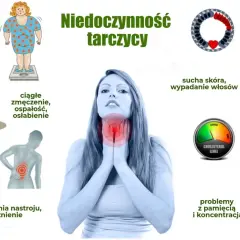 Objawy niedoczynności tarczycy: przyrost masy ciała, zmęczenie, bóle mięśni, wahania nastroju, sucha skóra, wypadanie włosów, wysoki cholesterol, problemy z pamięcią.