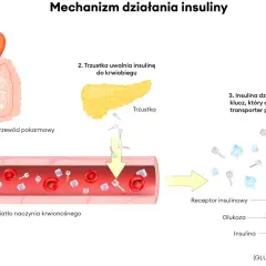 Po jedzeniu poziom glukozy rośnie. Trzustka uwalnia insulinę, która działa jak klucz, otwierając transporter glukozy. Hiperglikemia reaktywna objawy.