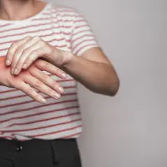 Dłoń z zaczerwienieniem, symbolizująca objawy neurologiczne twardziny układowej.