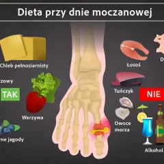 Dieta przy dnie moczanowej: TAK - nabiał niskotłuszczowy, chleb pełnoziarnisty, warzywa, wiśnie, czarne jagody. NIE - drób, łosoś, tuńczyk, czerwone mięso, podroby, owoce morza, alkohol. Jak obniżyć poziom kwasu moczowego?