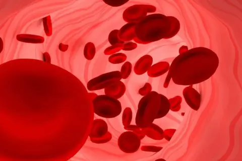 Czerwone krwinki w naczyniu krwionośnym. Duża ilość erytrocytów może sugerować podwyższona hemoglobina.
