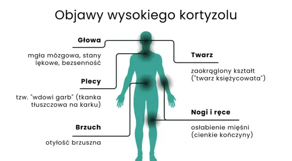 Wysoki kortyzol objawy: mgła mózgowa, lęki, bezsenność, "wdowi garb", otyłość brzuszna, okrągła twarz, osłabienie mięśni.