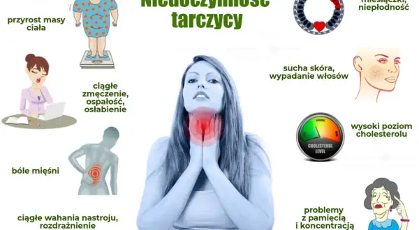 Objawy niedoczynności tarczycy: przyrost masy ciała, zmęczenie, bóle mięśni, wahania nastroju, sucha skóra, wypadanie włosów, wysoki cholesterol, problemy z pamięcią.