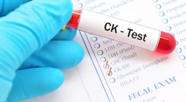Rękawiczka trzyma probówkę z napisem "CK - Test". Obok zaznaczono "CK-MB", co może być związane z podwyższona kinaza kreatynowa objawy.