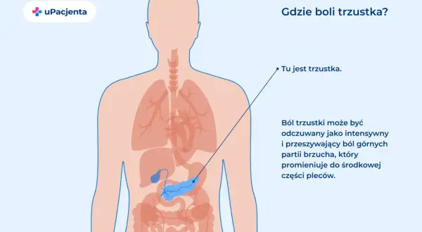 Ból trzustki może promieniować do pleców. Ilustracja pokazuje lokalizację trzustki w ludzkim ciele.