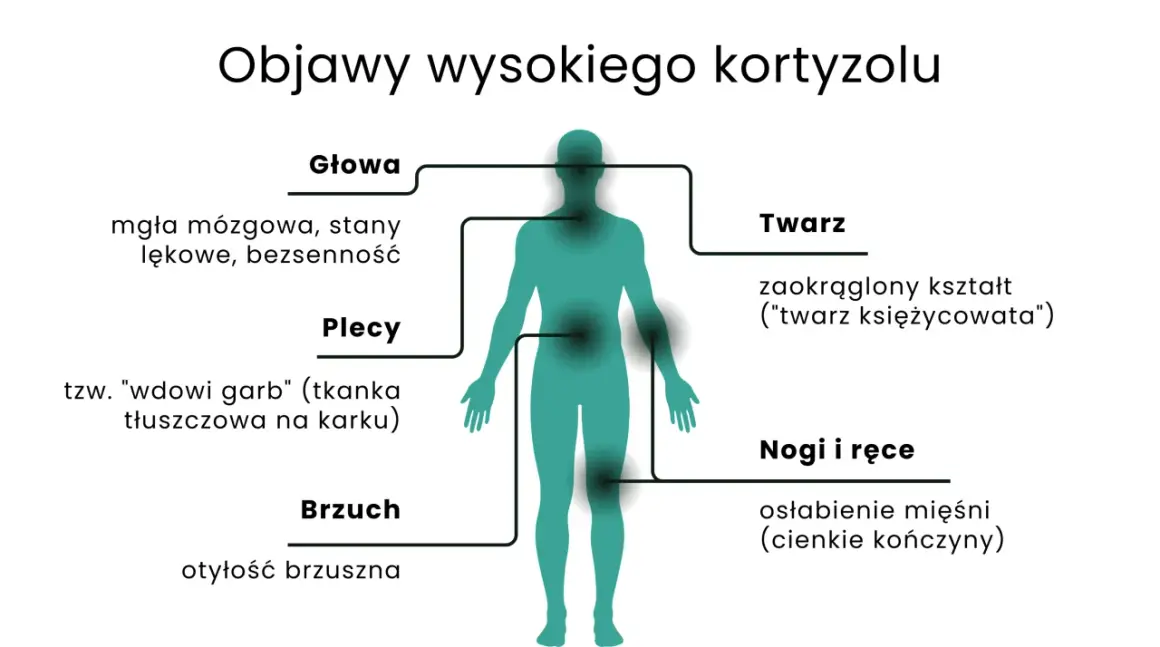 Wysoki kortyzol objawy: mgła mózgowa, lęki, bezsenność, "wdowi garb", otyłość brzuszna, okrągła twarz, osłabienie mięśni.