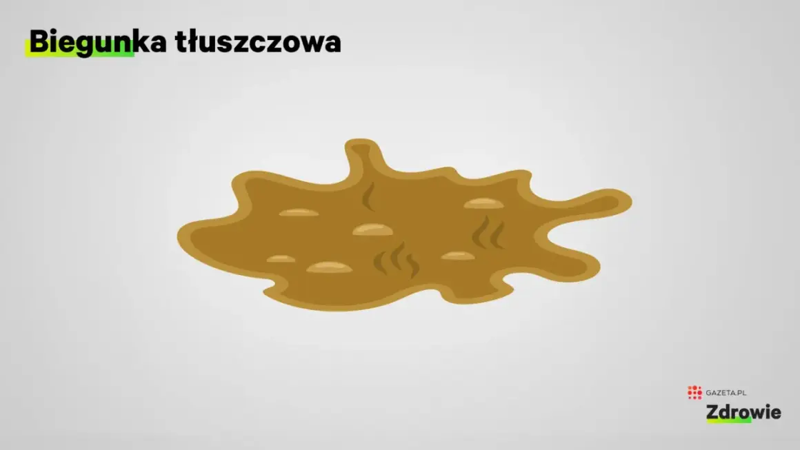 Biegunka tłuszczowa objawia się jako luźny, oleisty, kleisty stolec, często unoszący się na powierzchni wody w toalecie.