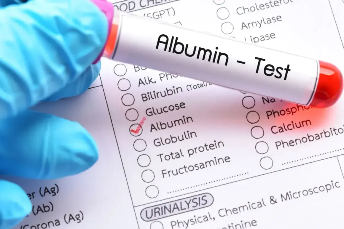 Rękawiczka w niebieskiej rękawiczce trzyma probówkę z napisem "Albumin - Test". Obok zaznaczono "Albumin" na formularzu badań, co sugeruje analizę albuminy w moczu i jej normy.