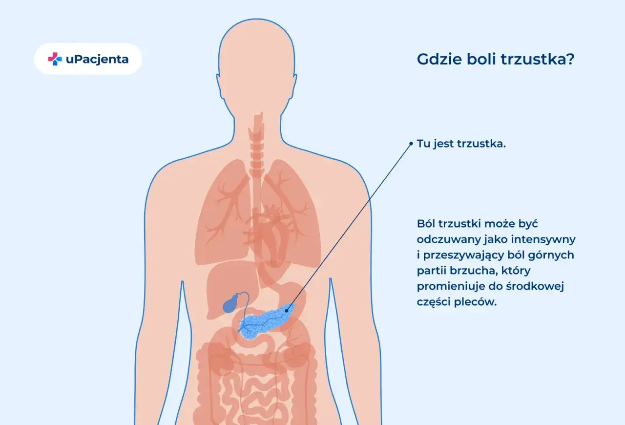 Ilustracja pokazuje lokalizację trzustki. Ból trzustki może promieniować do pleców.