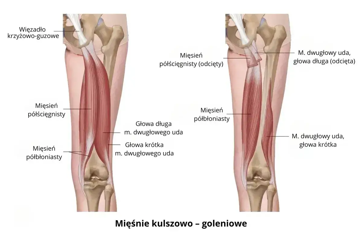 Anatomia uda: mięśnie kulszowo-goleniowe, w tym mięsień dwugłowy uda z głową długą i krótką, oraz mięsień półścięgnisty i półbłoniasty.