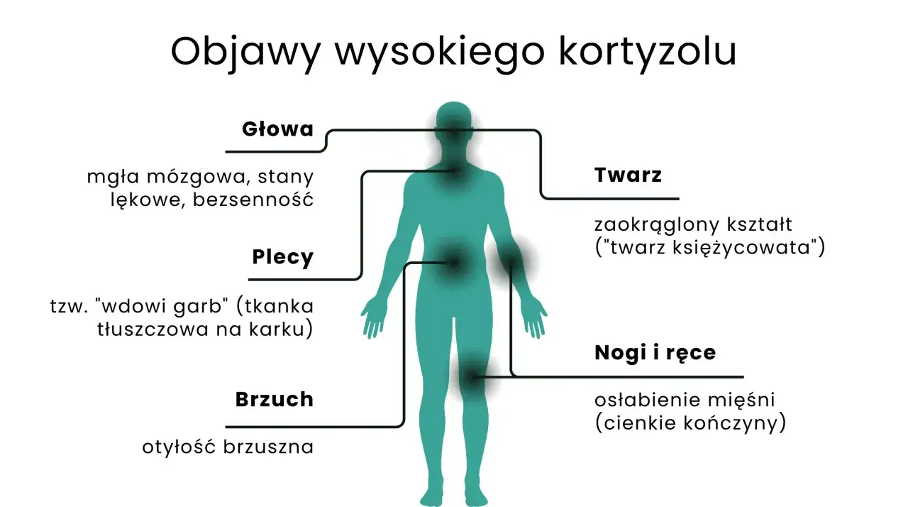 Wysoki kortyzol objawy: mgła mózgowa, lęki, bezsenność, garb, otyłość brzuszna, twarz księżycowata, osłabienie mięśni.