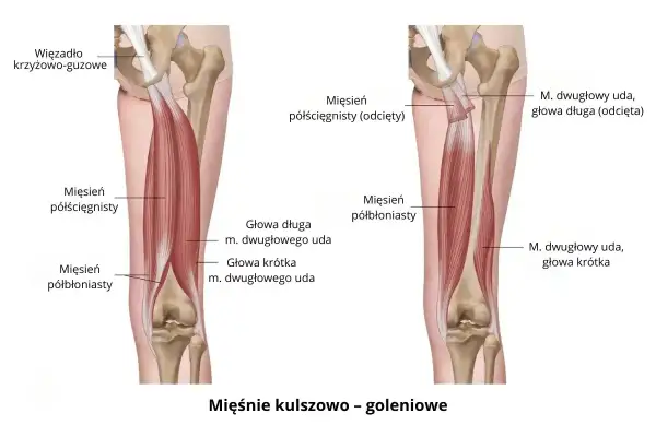 Anatomia uda: mięśnie kulszowo-goleniowe, w tym mięsień dwugłowy uda z głową długą i krótką, oraz mięsień półścięgnisty.