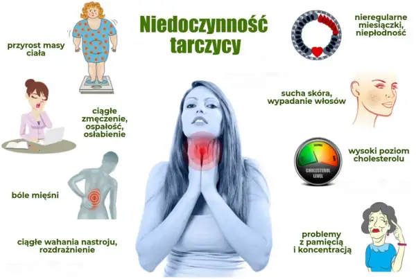 Objawy niedoczynności tarczycy: przyrost masy ciała, zmęczenie, bóle mięśni, wahania nastroju, sucha skóra, wypadanie włosów, wysoki cholesterol, problemy z pamięcią.