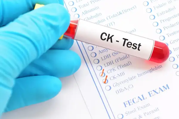 Rękawiczka trzyma probówkę z napisem "CK - Test". Obok zaznaczono "CK-MB", co może być związane z podwyższona kinaza kreatynowa objawy.