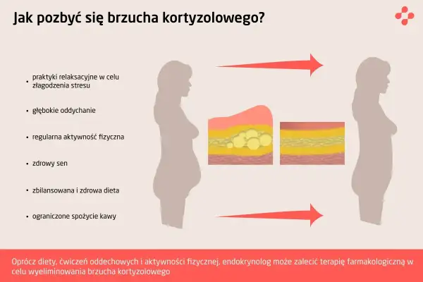 Grafika pokazuje, jak pozbyć się brzucha kortyzolowego poprzez relaks, ćwiczenia, sen i dietę. Zmniejszenie poziomu kortyzolu pomaga zredukować tkankę tłuszczową.