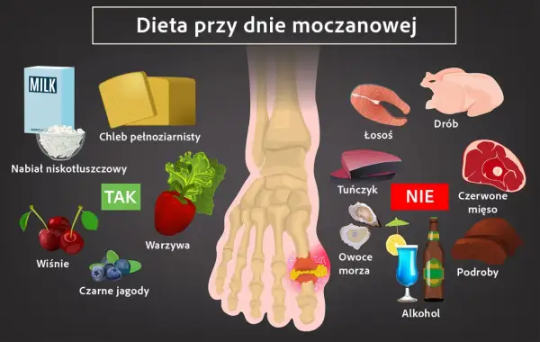 Dieta przy dnie moczanowej: TAK - nabiał niskotłuszczowy, chleb pełnoziarnisty, warzywa, wiśnie, czarne jagody. NIE - drób, łosoś, tuńczyk, czerwone mięso, podroby, owoce morza, alkohol. Jak obniżyć poziom kwasu moczowego?